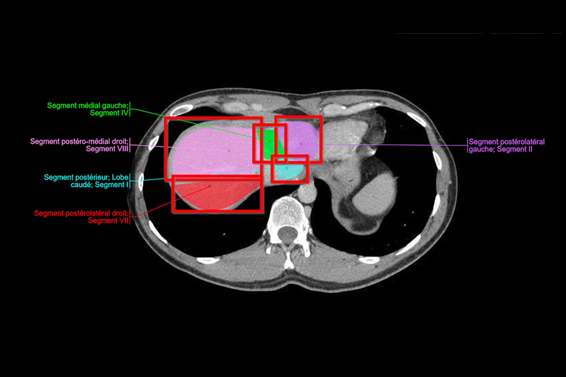 Medical Image Captioning
